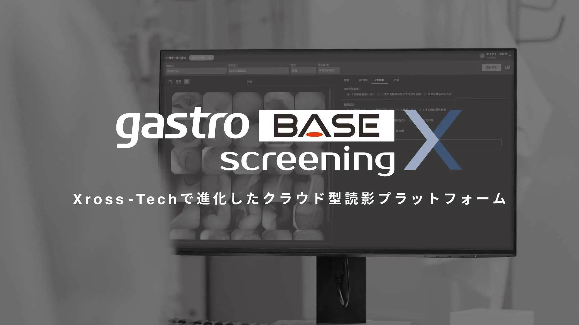 対策型胃がん健診サポート　gastroBASE screening X