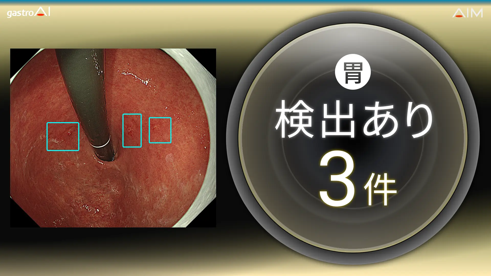 内視鏡画像診断用ソフトウェア　gastroAI™ model-G2