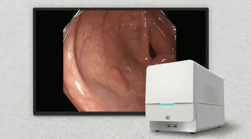 内視鏡画像診断用ソフトウェア　gastroAI-model G