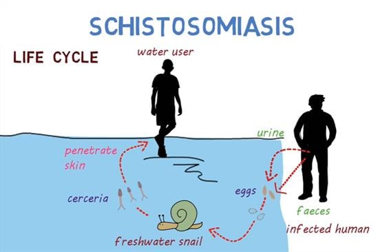Schistosomiasis (Bilharzia) clip – an overview