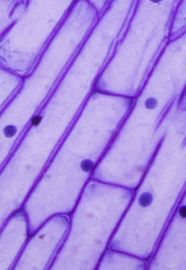 Purple onion peel under the microscope