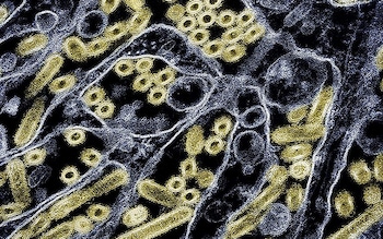 A colorised transmission electron micrograph of avian influenza A H5N1 virus particles