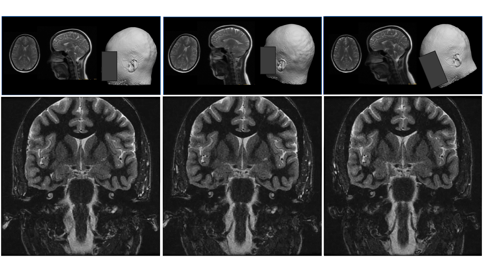 Consistent brain image orientation irrespective of various head rotations.