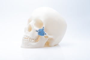 3D Printed Ceramics for MedTech: Multifeature Disruption