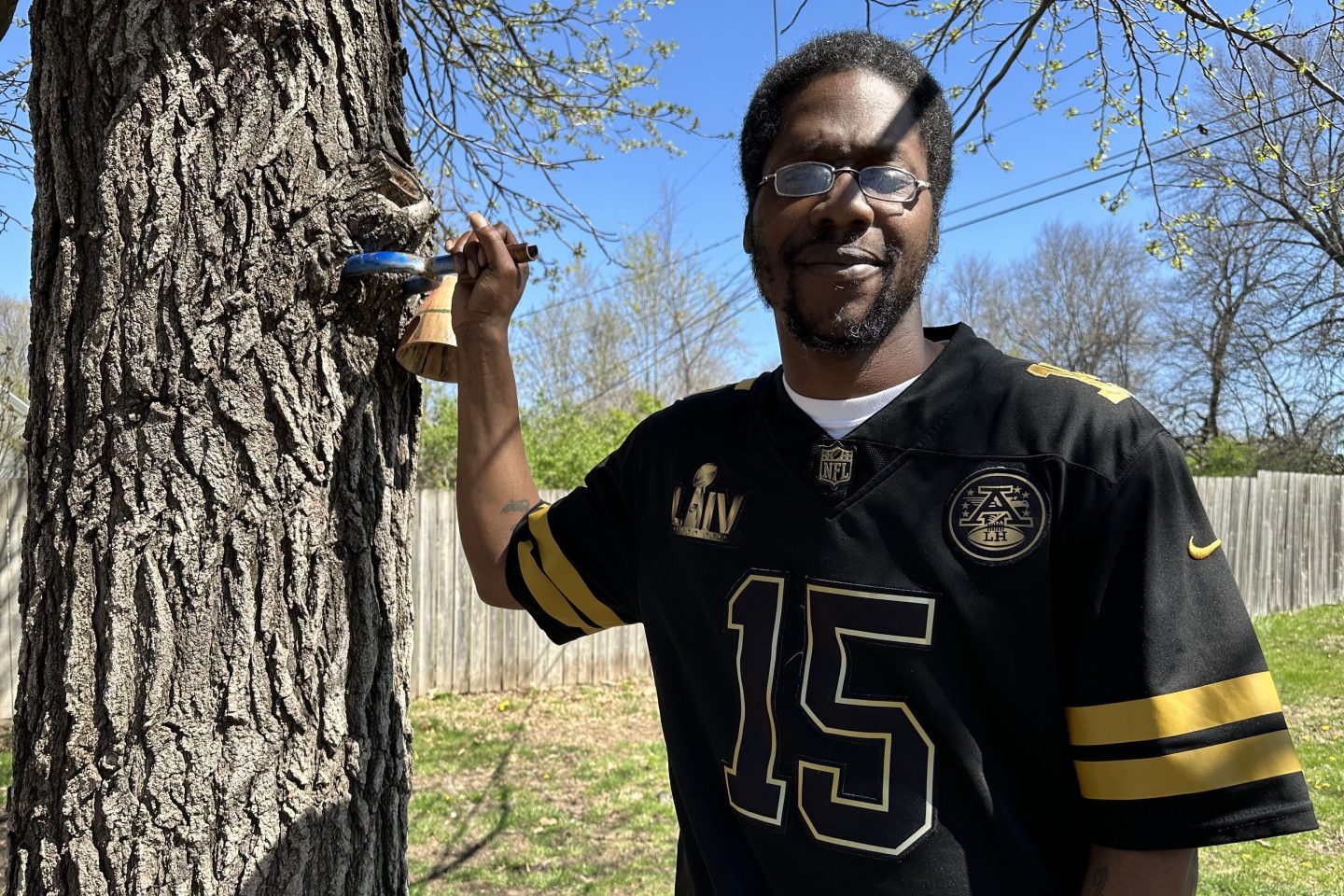 After being shot in the leg at the Kansas City Chiefs Super Bowl parade, James Lemons was initially told the bullet would stay there, unless it became a problem. “I get it, but I don&#8217;t like that,” Lemons says. “Why wouldn’t you take it out if you could?” (Bram Sable-Smith/KFF Health News)
