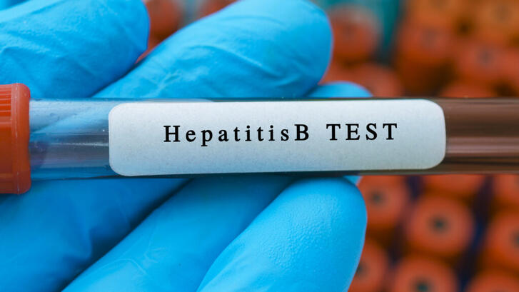 Photo of Hepatitis B Test
