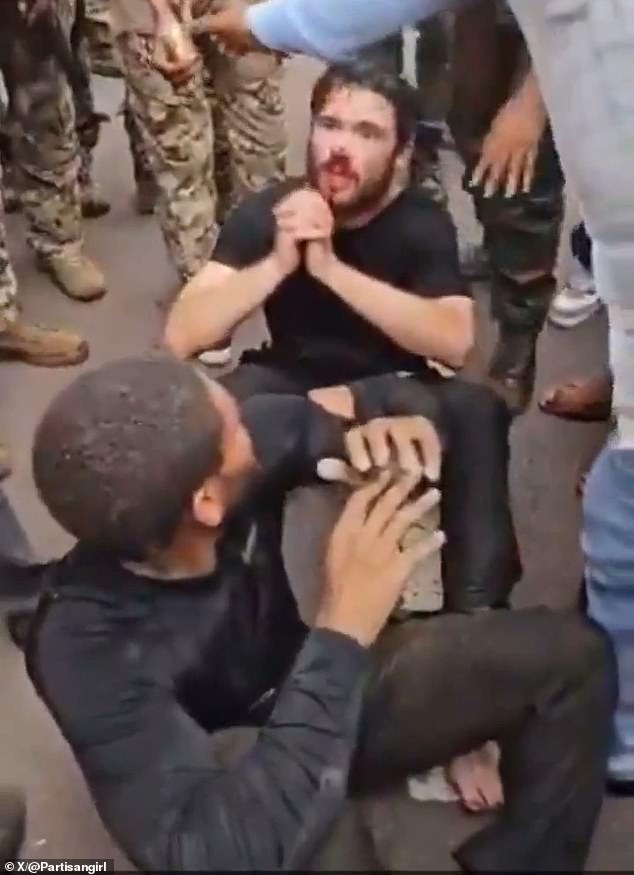 The men appeared bloodied at battered as they sat in the street following the failed coup