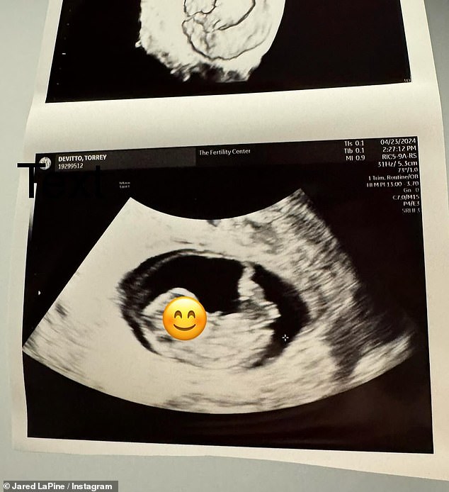 LaPine also shared a photo of a sonogram that had been taken during one of DeVitto's recent checkups