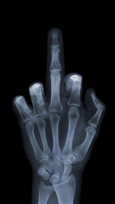 Hand X-Ray | Middle finger wallpaper, Hd phone wallpapers, Android wallpaper