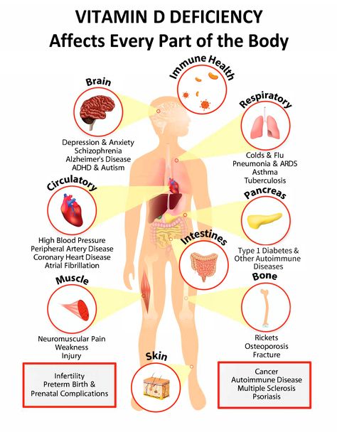 Interactive PDF: How Vitamin D Deficiency Affects Every Part of the Body - GrassrootsHealth Fitness, Autoimmune Disease, Endocrine, Vitamin D Deficiency Symptoms, Vitamin D Deficiency, Immune Health, Vitamin D3, Autoimmune, Coronary Heart Disease
