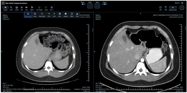 Explore how the Cloud Healthcare API can be used to store, retrieve, and analyze medical imaging data