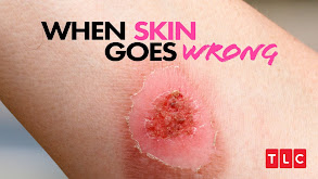 When Skin Goes Wrong thumbnail
