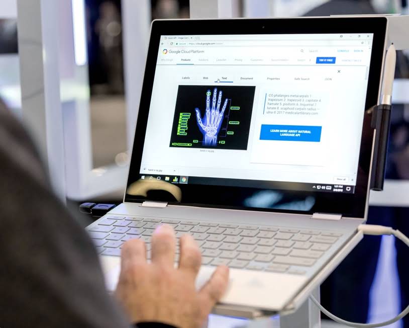 Mężczyzna patrzący na zdjęcie rentgenowskie wyświetlane w interfejsie Google Cloud Platform na Chromebooku.