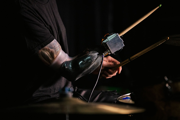 A closeup of Jason’s prosthetic arm as he plays the drums.