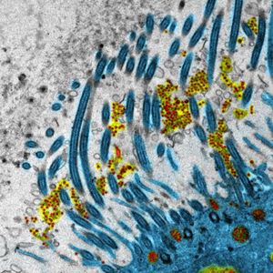 Image d'un épithélium respiratoire humain infecté par le Sars-CoV-2, obtenue par microscopie électronique à transmission sur la plateforme d'imagerie de l'Université Claude Bernard Lyon 1.