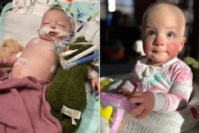 Mom Speaks Out After Infant Nearly Dies from Ingesting a Single Water Bead: 'It Still Shocks Me'