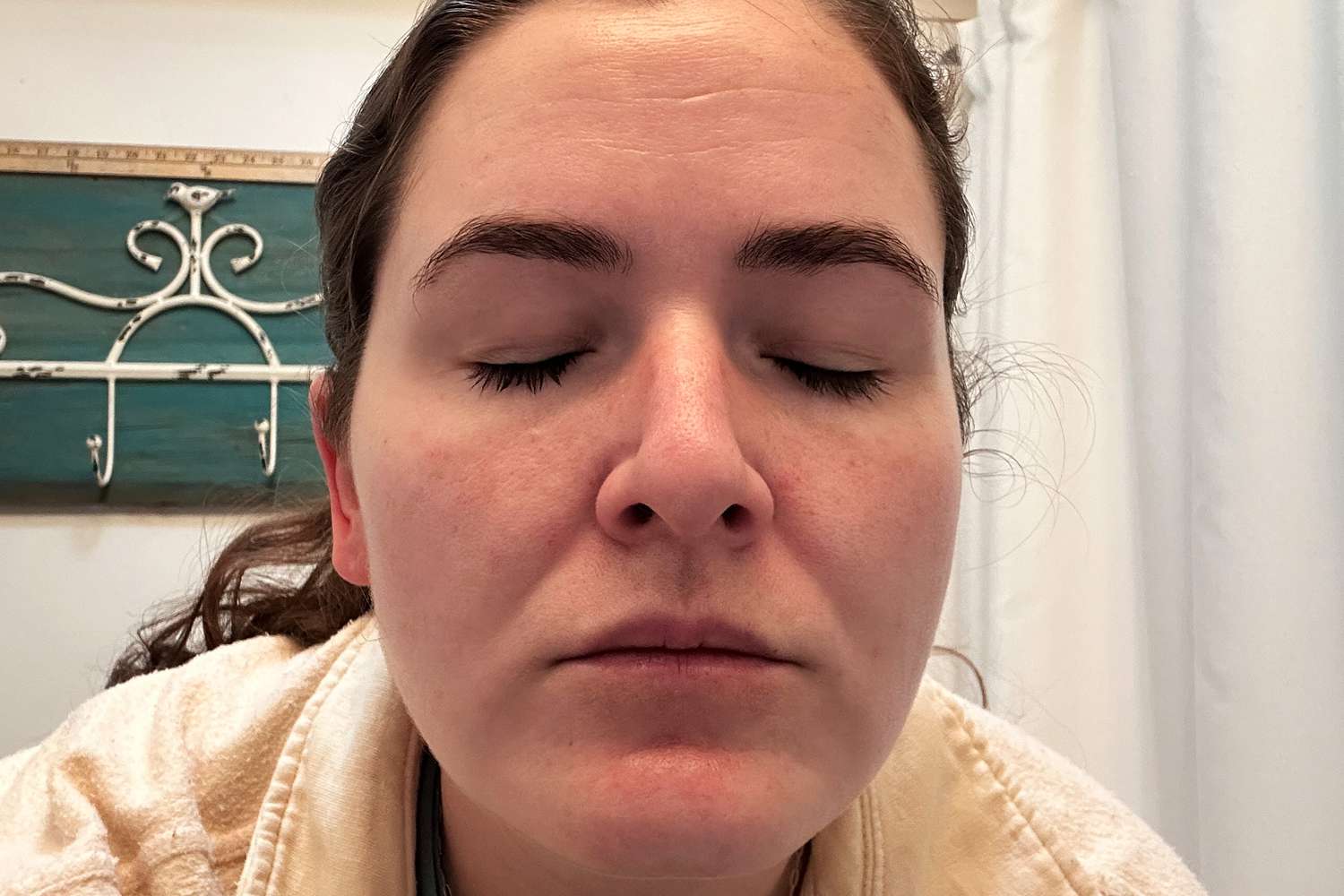 Person showing face results after using the La Roche Posay Retinol B3 Pure Retinol Serum