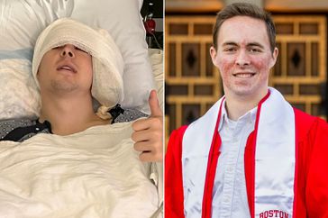22-Year-Old Graduates College After Undergoing Two Brain Surgeries: ÂMy Body Was Rebelling Against Me