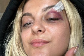 Bebe Rexha after being hit with phone on stage