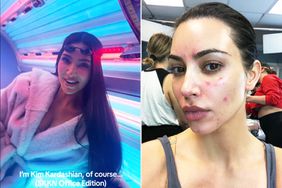 Kim Kardashian Defends Use of Tanning Beds: 'I Have Psoriasis and It Helps'