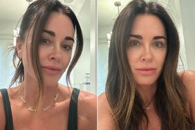 Kyle Richards Posts Makeup-Free Selfie After Microblading Brows and Getting Lip Blushing