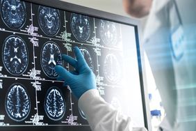 Stock image of Doctor analyzing patients brain scan on screen