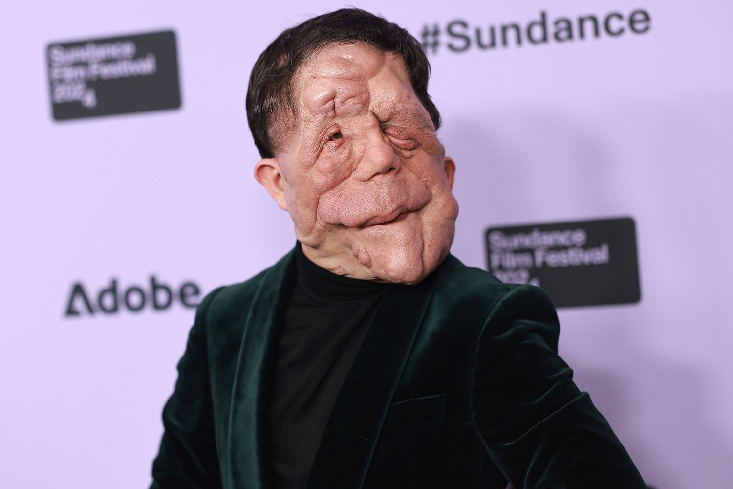 Adam Pearson attends the "A Different Man" Premiere during the 2024 Sundance Film Festival at Eccles Center Theatre on January 21, 2024 in Park City, Utah.