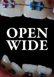 Open Wide की आइकॉन इमेज