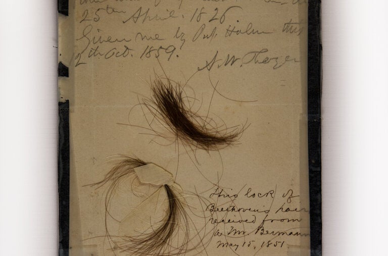 Dos mechones autentificados de pelo de Beethoven recogidos por Alexander Thayer, en los que se encontraron niveles asombrosos de plomo por gramo de pelo.
