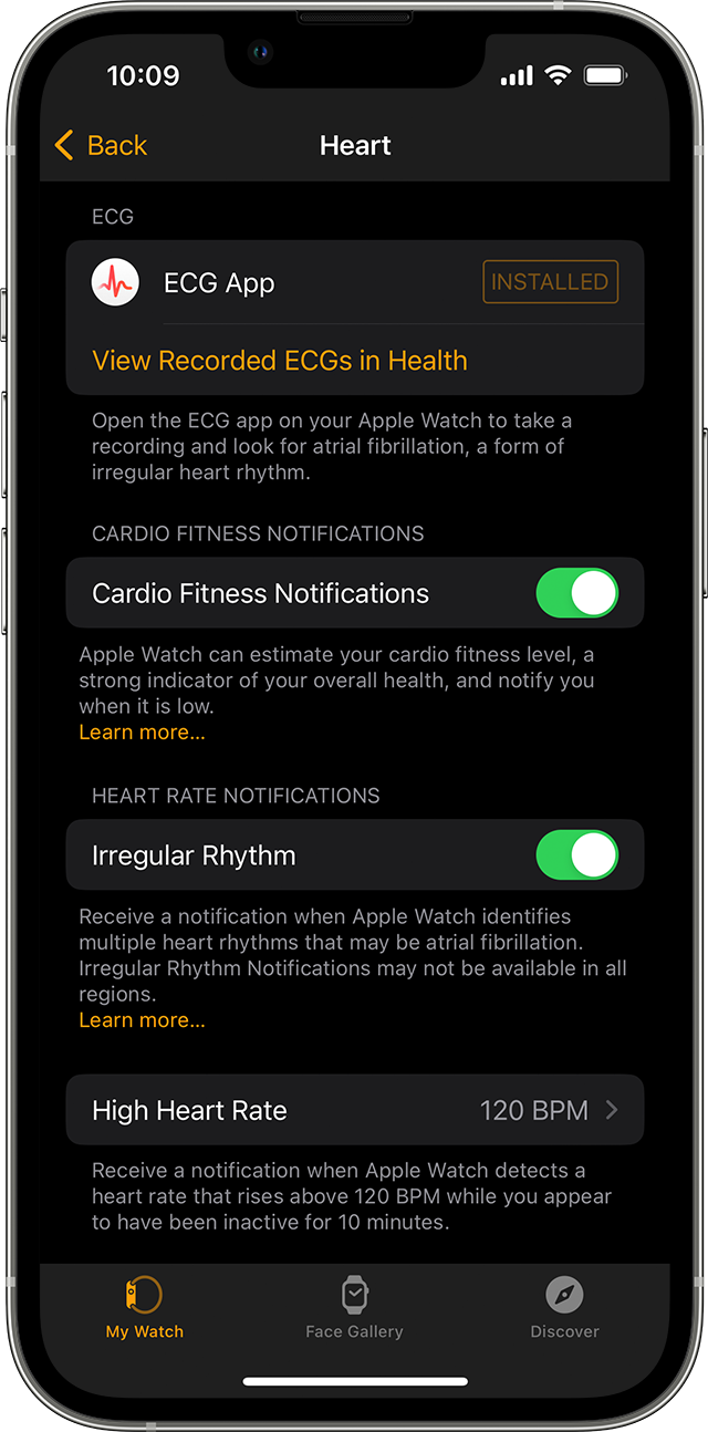 Nastavitve aplikacije Heart v napravi iPhone.